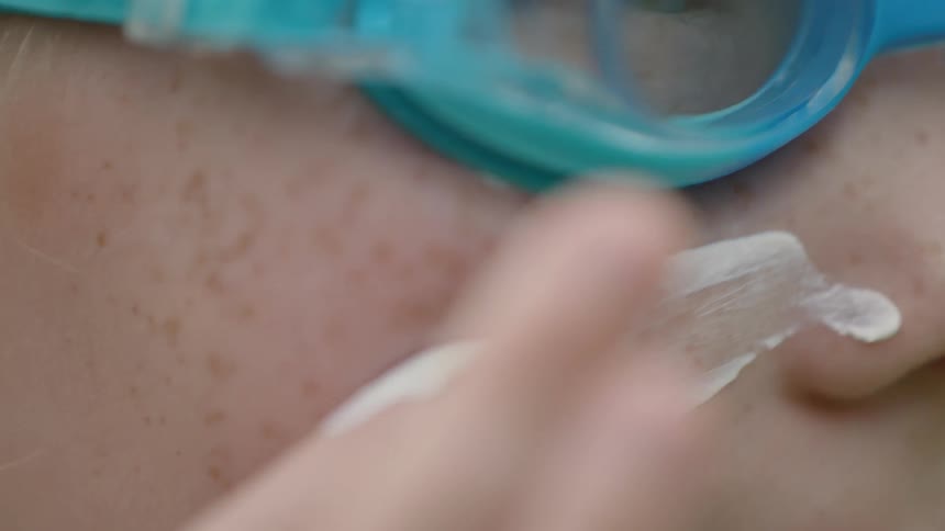Lady on blue goggles rubs a white lotion on her nose and cheek
