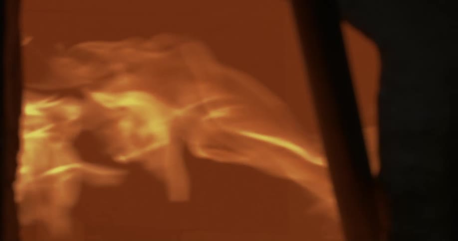 Flames illuminating the dark environment