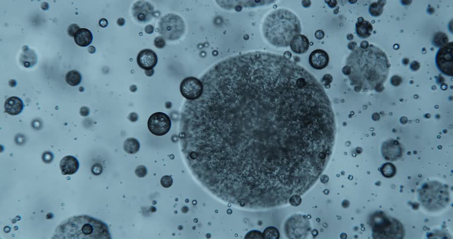 Microscopic bubbles in a blue fluid