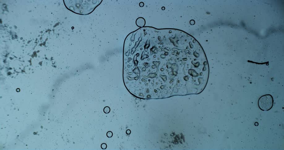 Extreme closeup of a dense liquid with abstract and microscopic bubbles in motion