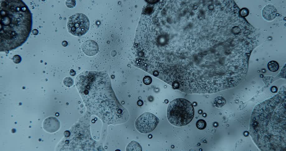 A microscopic view of particles and bubbles in a fluid