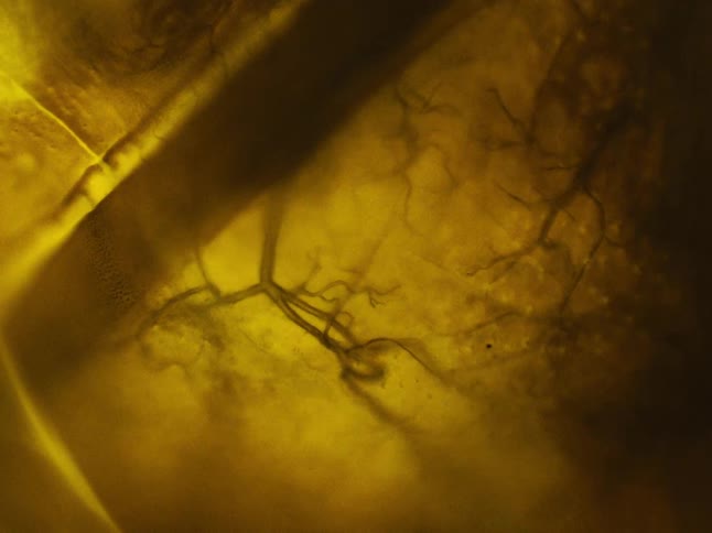 Microscopic shot of small veins pulsing