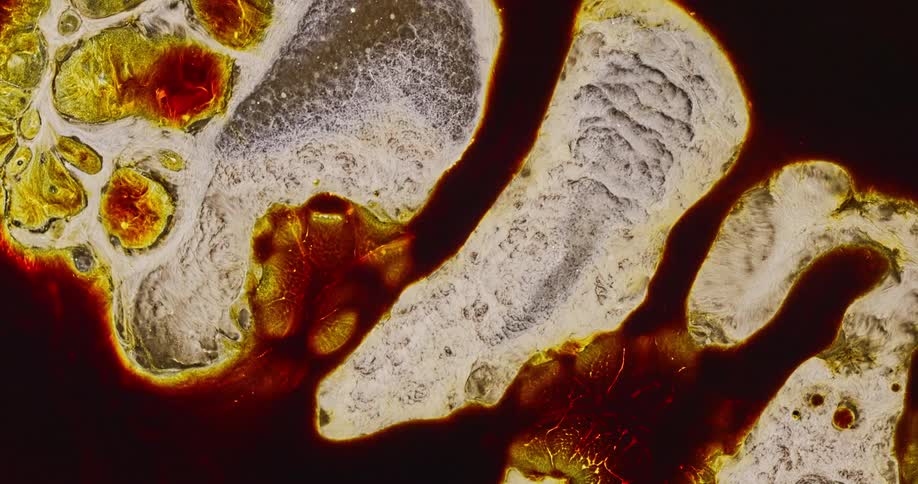 Holes form in the liquid