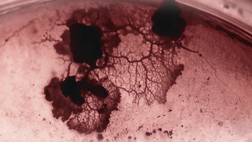 A bacteria fungus spreads quickly; an outbreak in a science petri dish