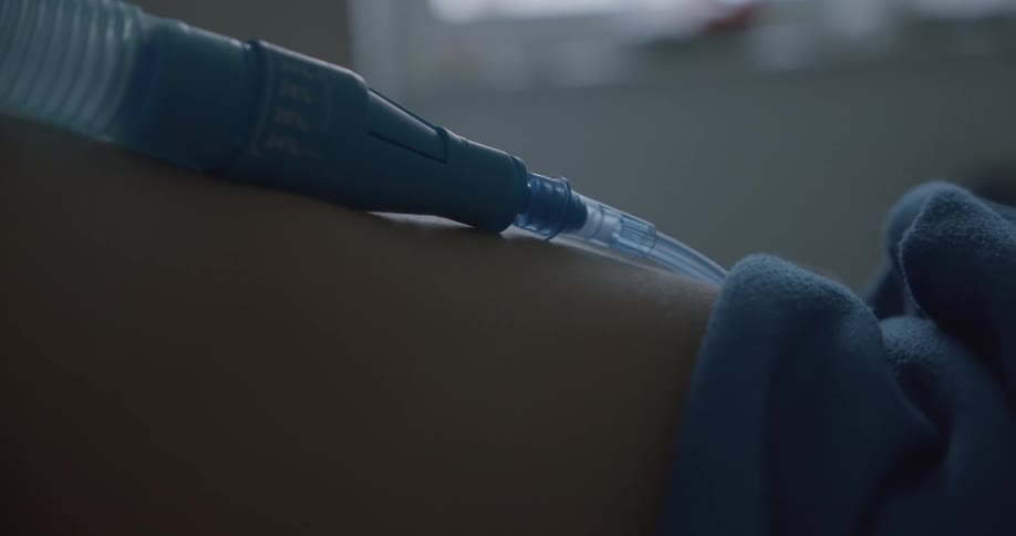 Childpatient in hospital breathes with the help of oxygen tube