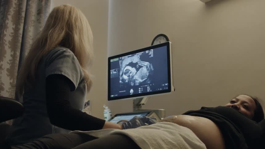 A woman is getting an ultrasound