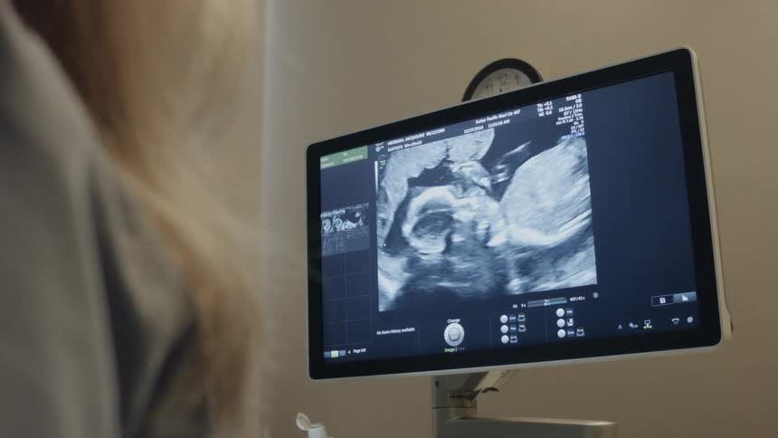 A woman is looking at a ultrasound