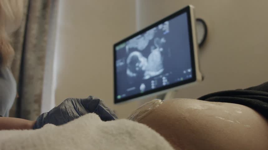 A pregnant woman is being given a sonogram