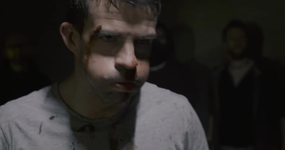 A man is covered with cuts and blood and grabs his head
