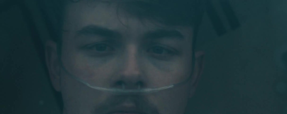 A patient has a tube going in his nose