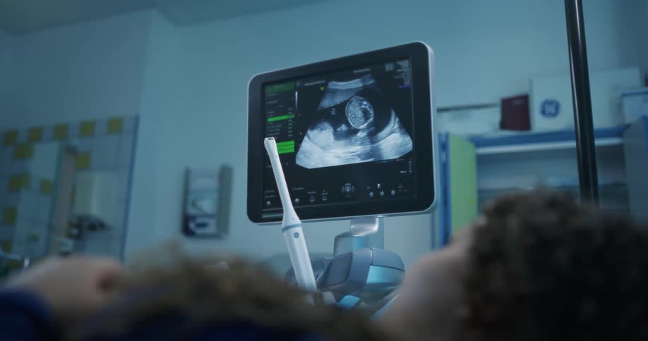The pregnant woman is watching her unborn baby on the ultrasound screen
