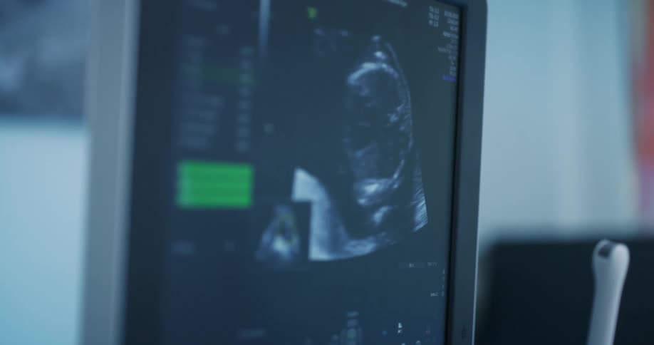 Closeup of a multimedia performing an ultrasound on a pregnant woman
