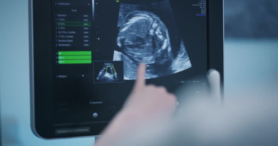 A woman points at a screen showing a sonogram