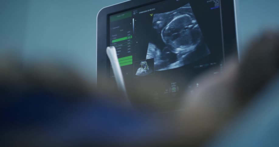 A person is getting a test on medical equipment