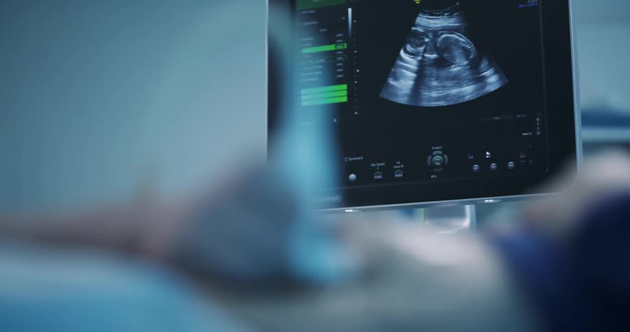 A patient in a hospital undergoing an ultrasound examination