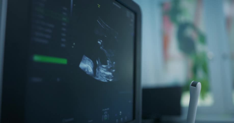 A pregnant woman is getting a sonogram