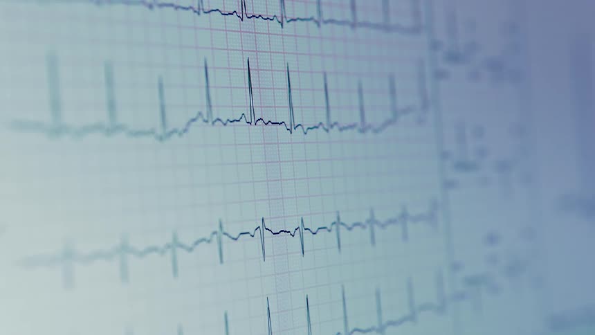 Closeup on a monitor passing magnetic medical waves