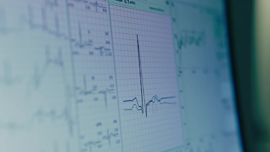 Heart rate showing on a monitor indoor