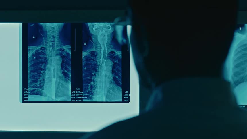 Doctor analyzing body xray images on a screen
