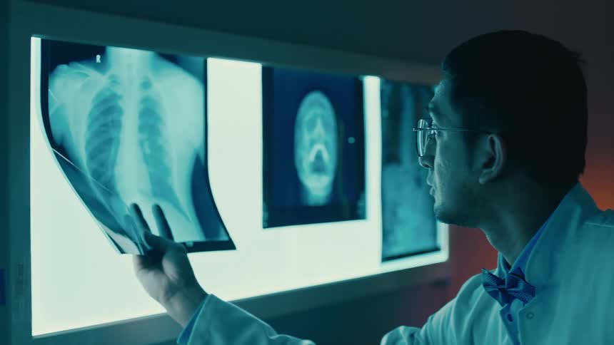A person is examining an xray film against a light source in a dimly lit room