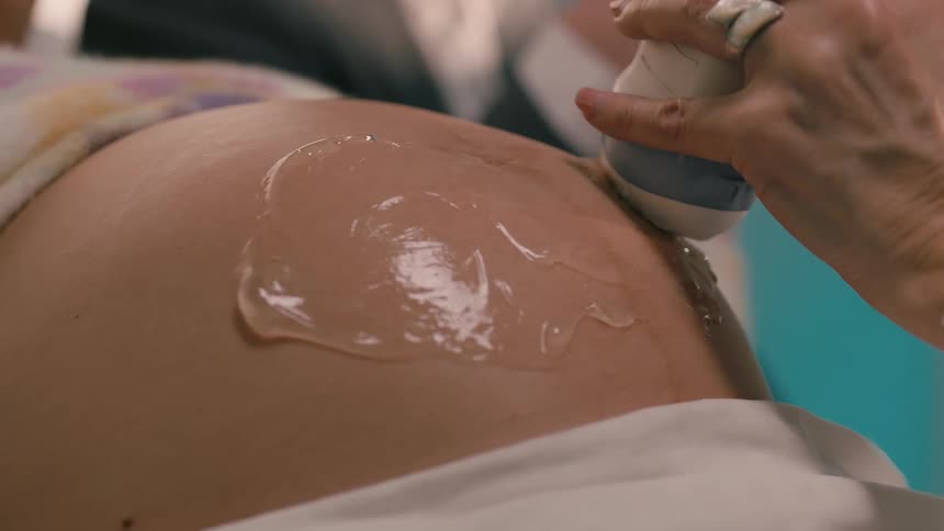 A woman is receiving a sonogram