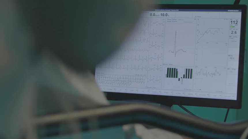 A person under a stress test in front of a computer monitor displaying various graphs and data