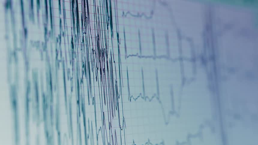 A view of a graph on a screen in a hospital