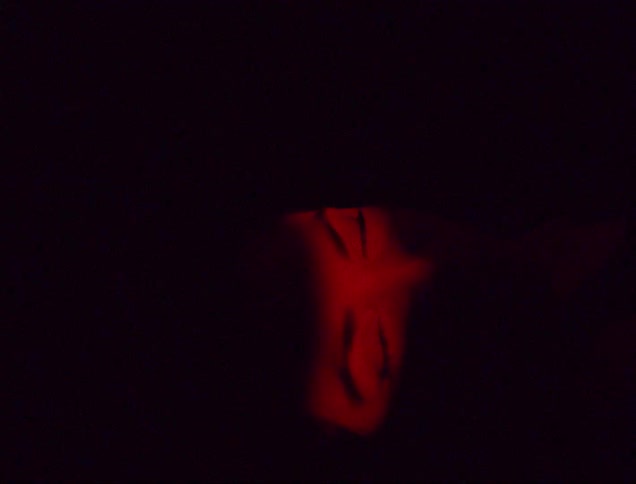 Red light flashes in the eyes of a female while laid on her back