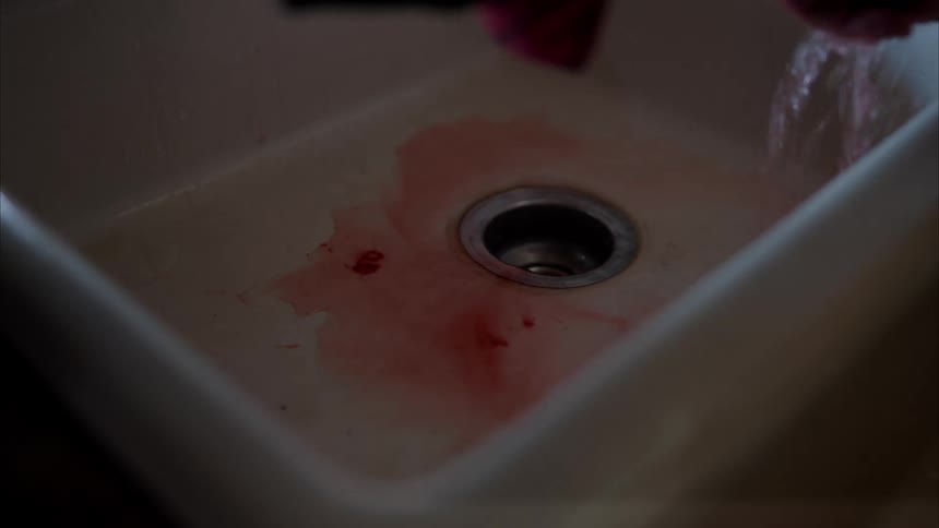 A person washing their bloody hands in a sink