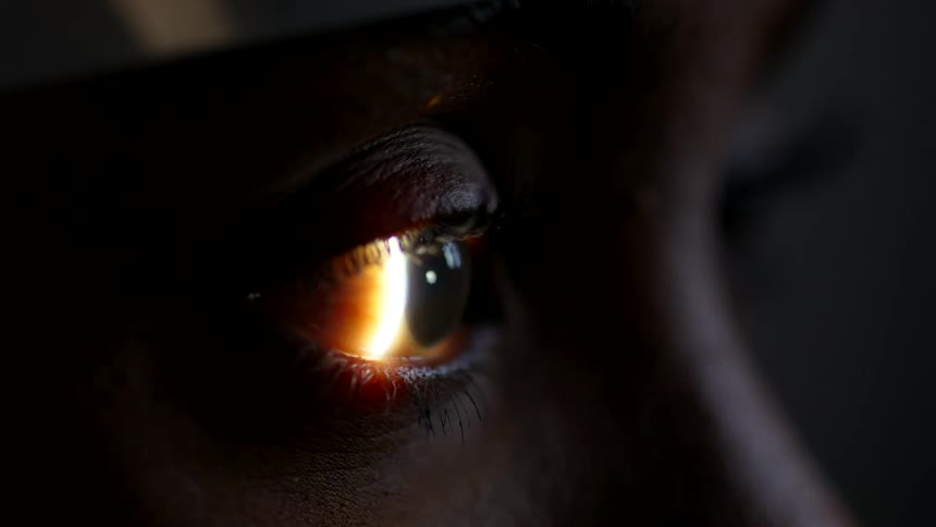 Close up of an eye being scanned with a ray of light