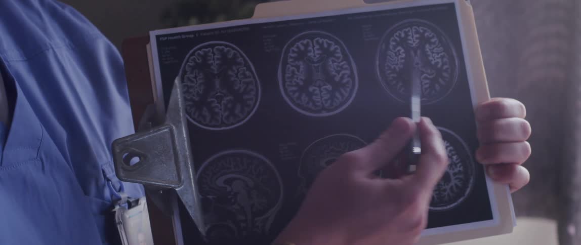 Male nurse explains a brain mri scan on a clipboard
