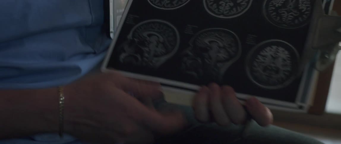 A nurse showing mri scans on a clipboard
