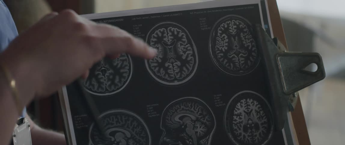 Hands of a doctor holding a clipboard with xrays of the brain and head and with a pen making an explanation