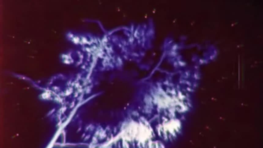 Microscopic image of an organism moving