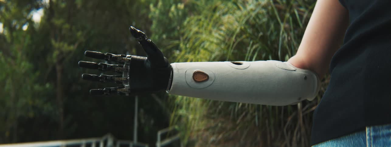 A woman tests her mechanical prosthetic hand by rotating opening and closing it then putting a camera on it to hold it
