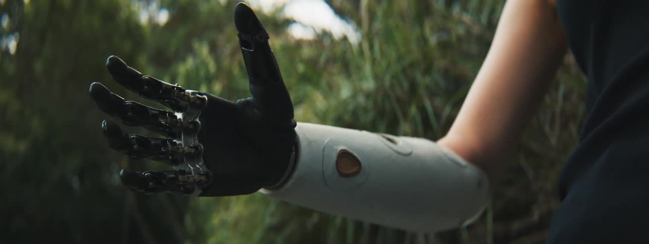 A woman testing her mechanic prosthetic hand by opening and closing it
