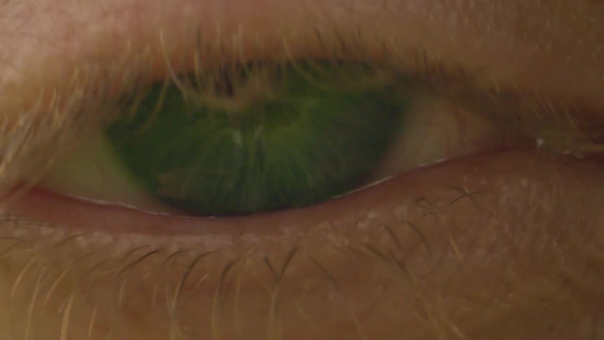 A person with green eyes are blinking rapidly