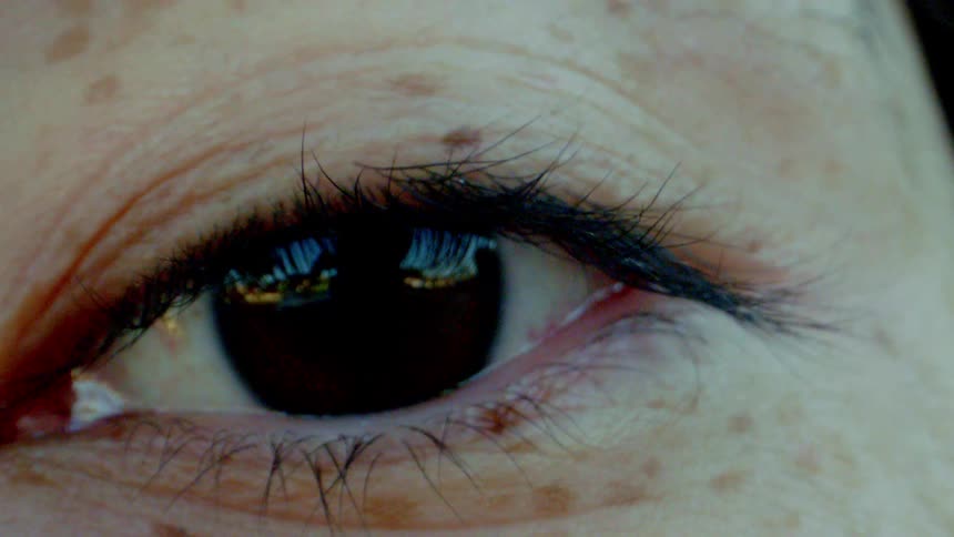 A reflection of buildings in a persons eye