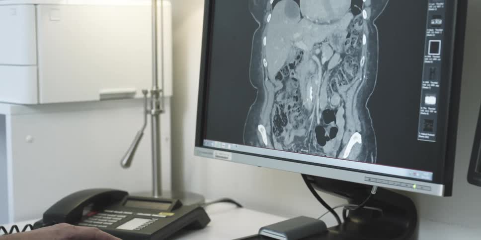 Computer monitor displaying a ct scan of the head
