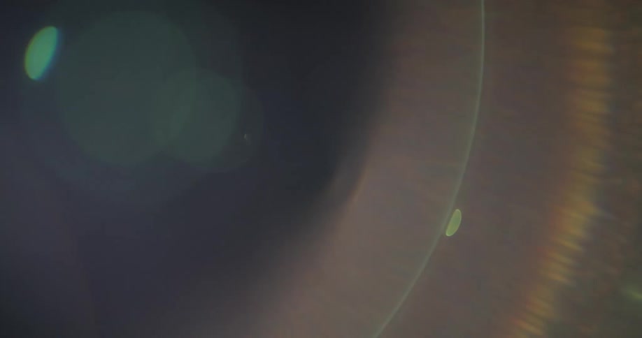 Close up of flares in a camera lens