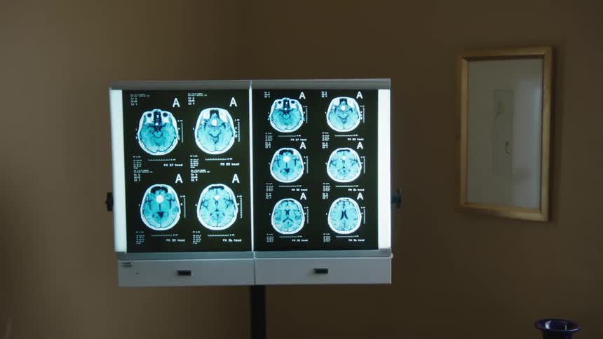 A black tomography with white and illuminated drawings
