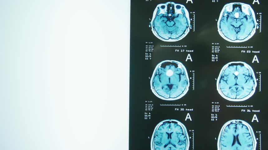 A healthcare worker puts a scanned image on a machine