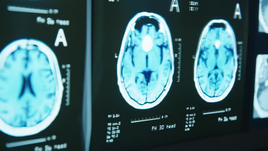 Medical scans displayed on screens