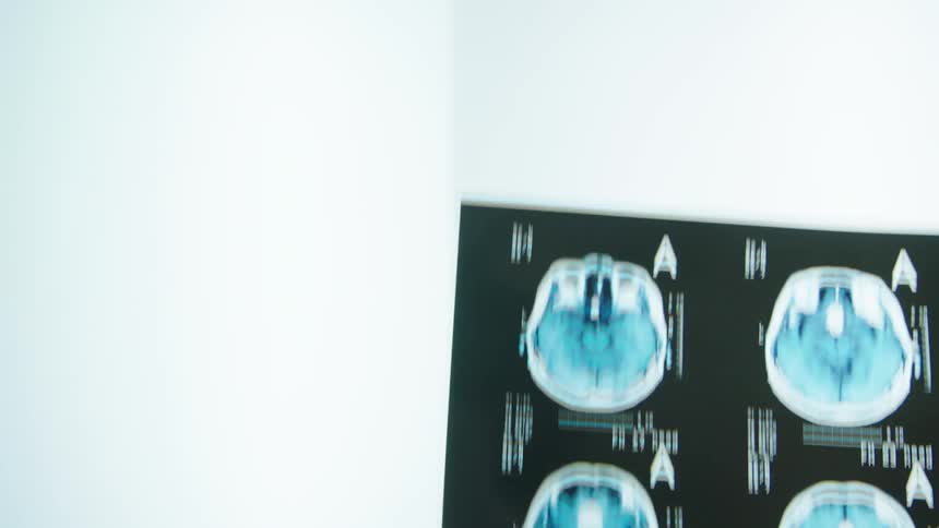 A series of medical images slid onto a backlight