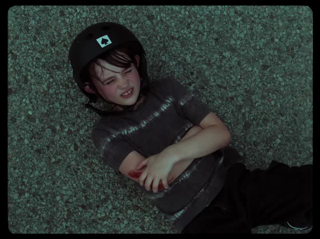 A boy lying on the ground with a helmet on holding his bleeding injured arm
