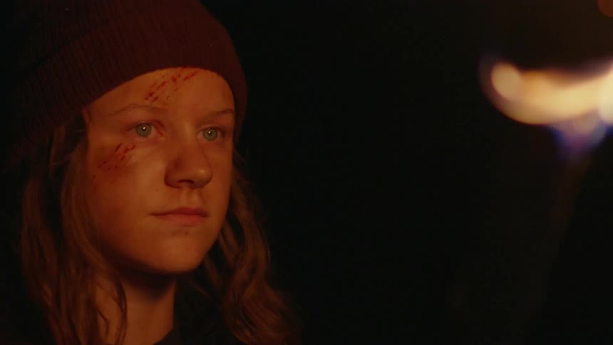 The face of a teenage person with red scars and his face is being illuminated by a torch that is in front of him