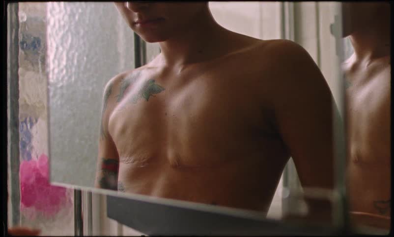 A bald woman applies ointment to her chest scars while standing in a bathroom