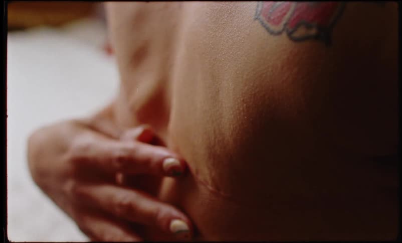 A bald tattooed woman touches the scars of a recent surgery in her chest