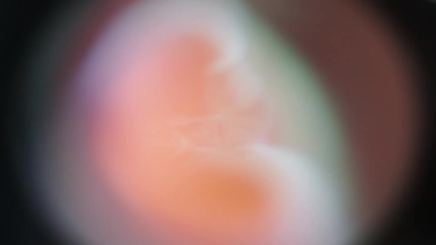 A metal pipe has a burst of fire that shoots through it and subsides