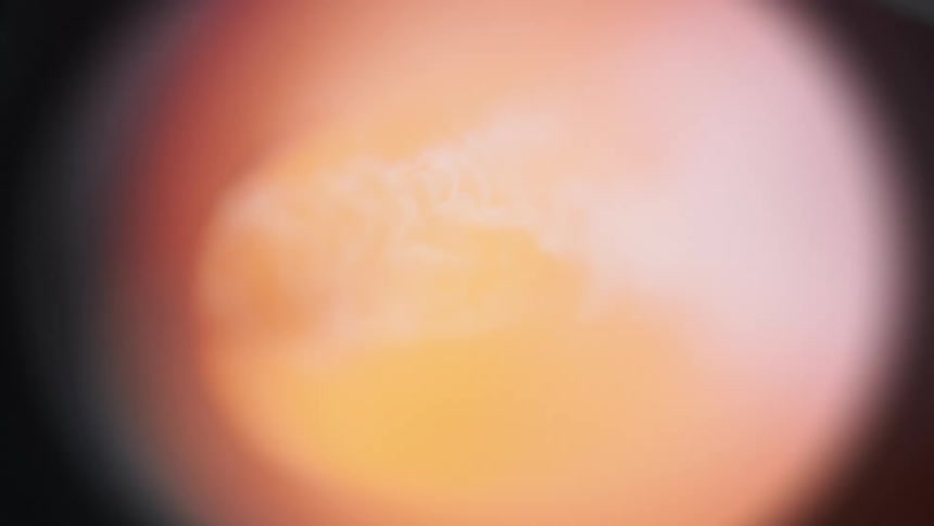 Flare in outer space brightens the gray band before disappearing again